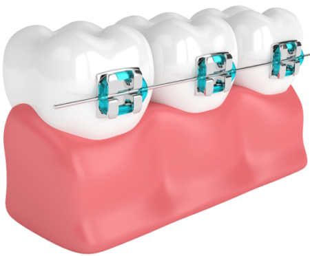 مرکز ارتودنسی دندان در سهروردی