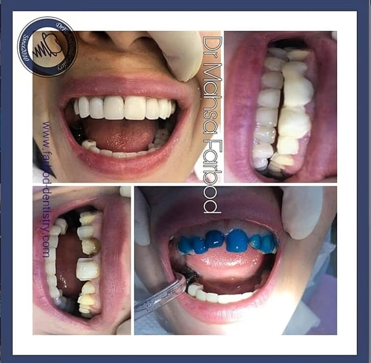 134-e1605448988563-min