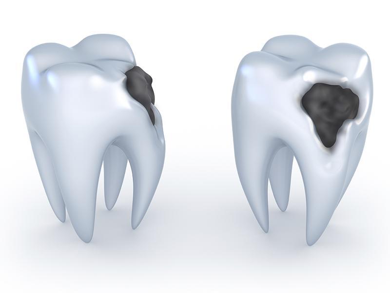 مرکز ترمیم دندان در سهروردی
