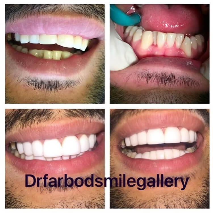 16907074_1349050918495794_7597438645703802880_n-min