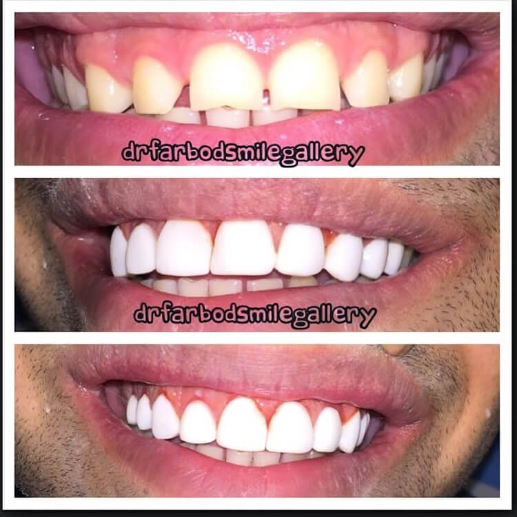 17075793_1903221223243424_7257437446730678272_n (1)-min