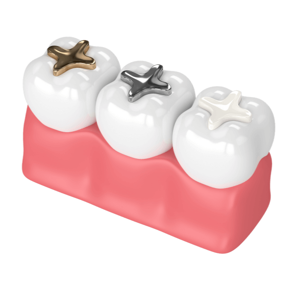 ترمیم دندان