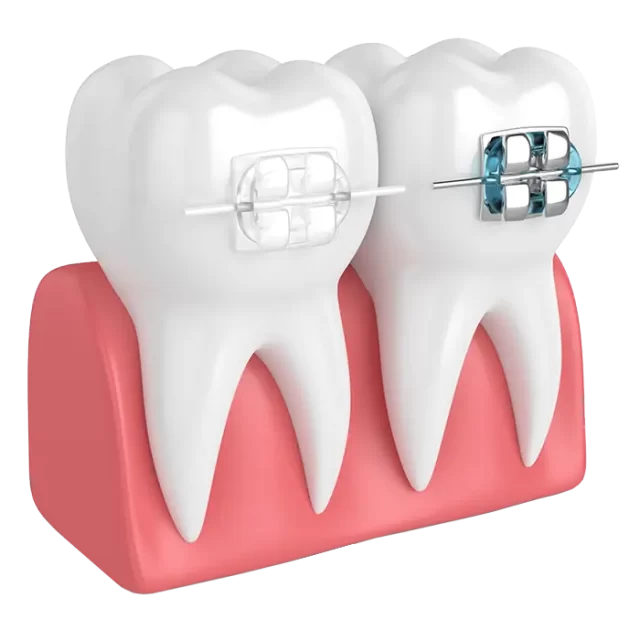 مرکز ارتودنسی دندان