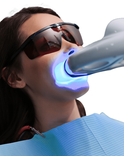 بلیچینگ دندان