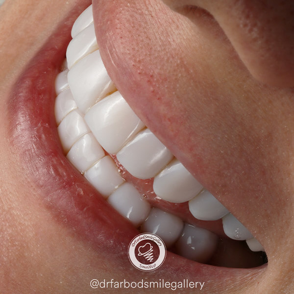 Untitled-12بیریبر4ق432ققل