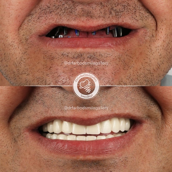 Untitled-13234234بلصثصب-min