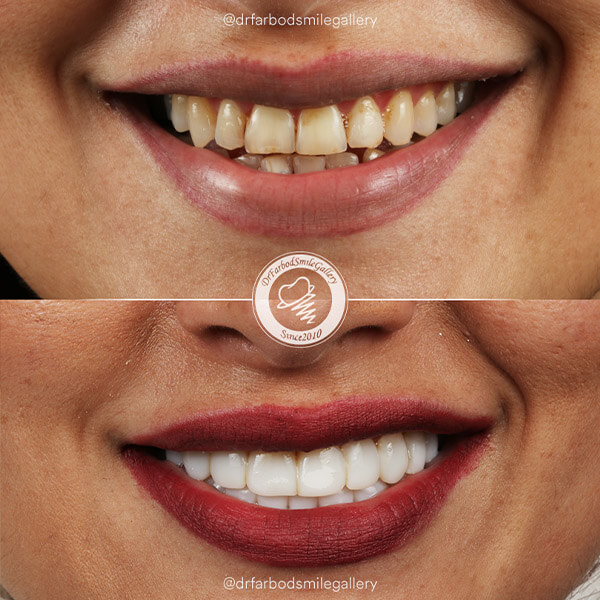 Untitled-134لاقفاقف5645للبر