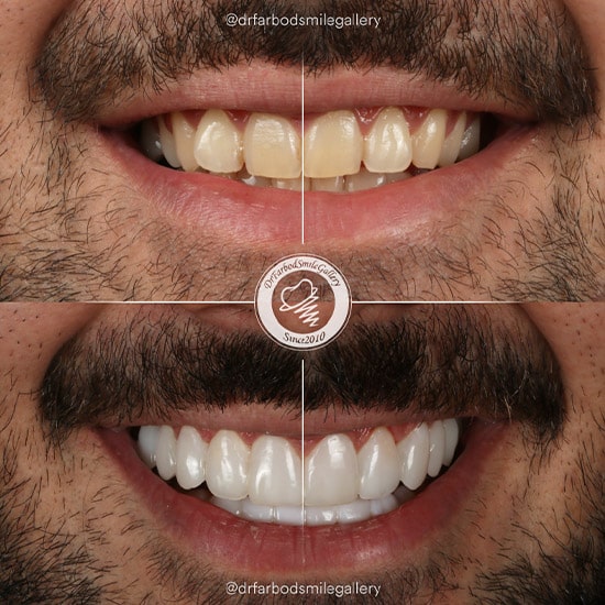 Untitled-1فص45ف-min