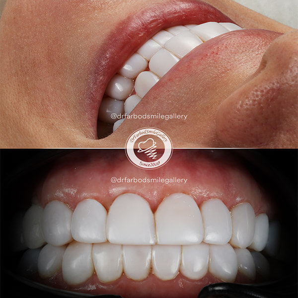 Untitled-23بلرثبلر43قلبثقل4