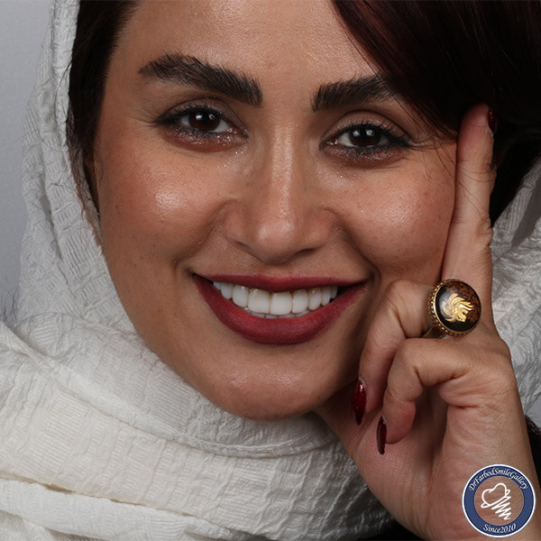 Untitled-3یبذریبذسر4لفذسفل5ل