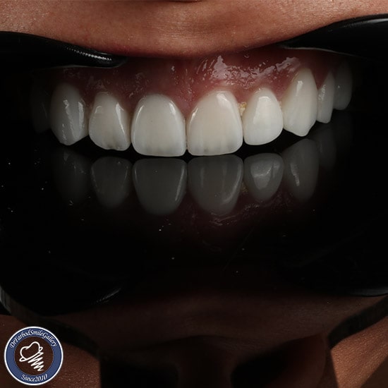 Untitled-4لاسقفقسیبلذرذ-min