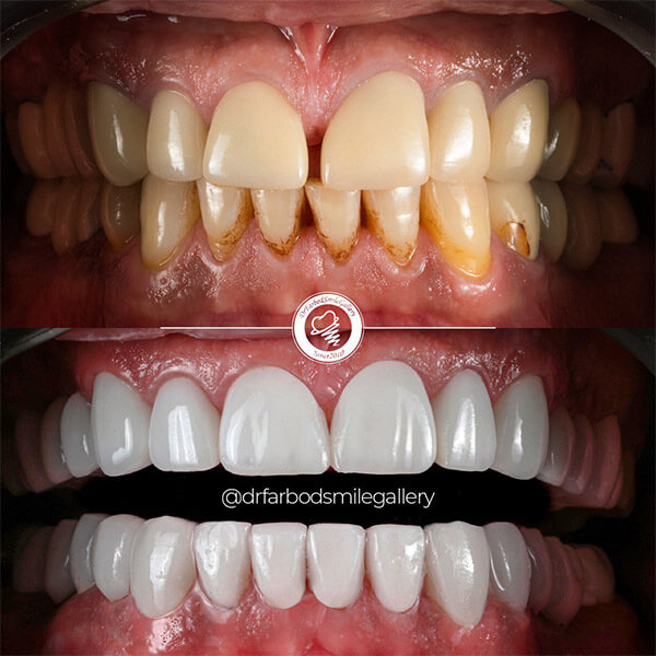 Untitled-7تفغتفغتقفغتقف676اتفغت6