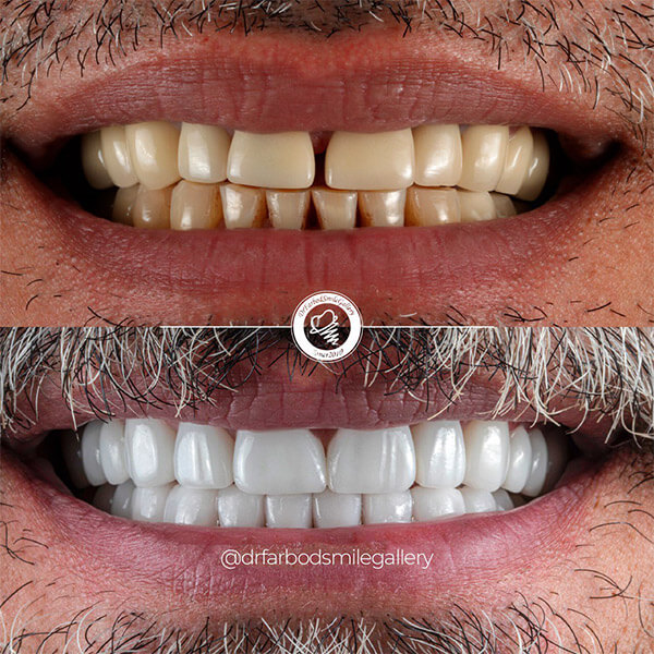 Untitled-90تنغن89عنع