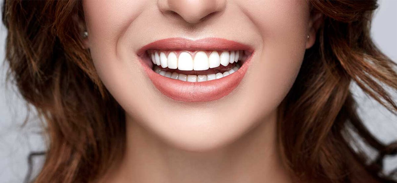 مرکز ونیر کامپوزیت دندان در سیدخندان