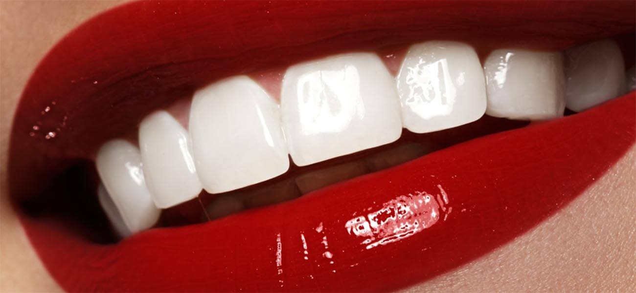 مرکز ونیر کامپوزیت دندان در سیدخندان