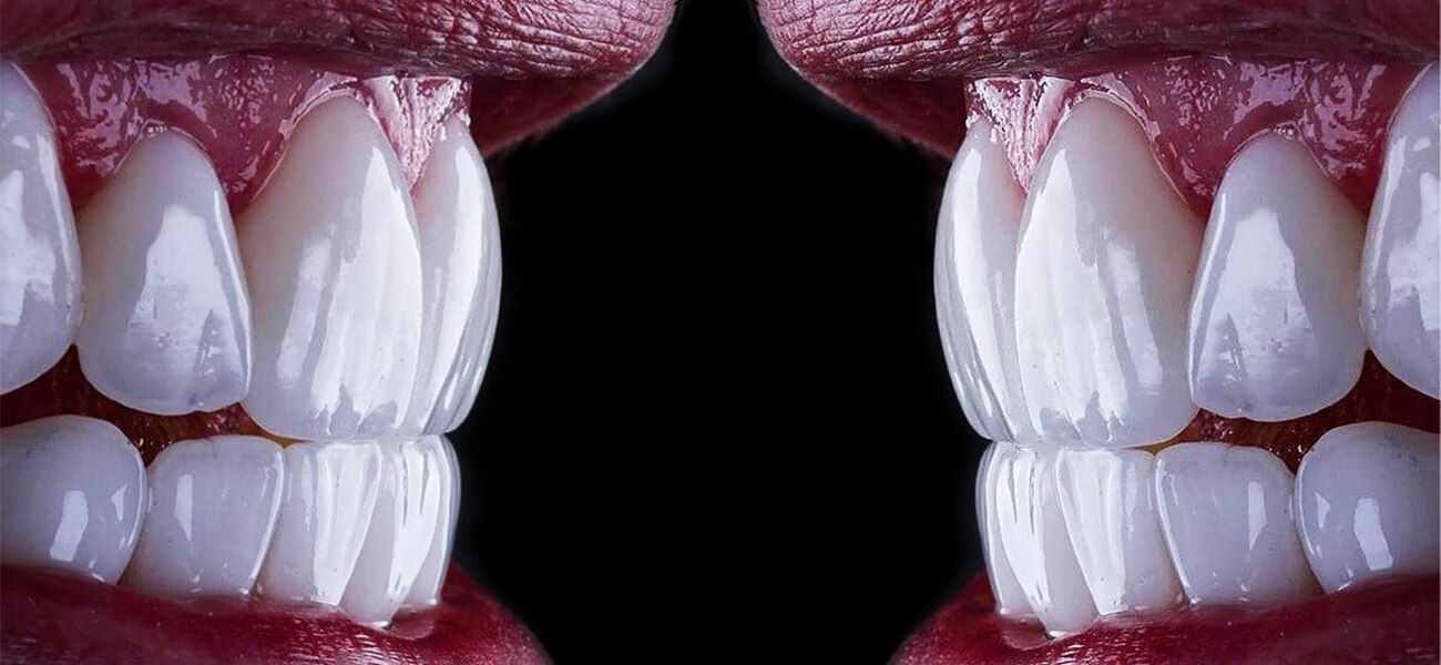 بهترین دندانپزشکی زیبایی سهروردی