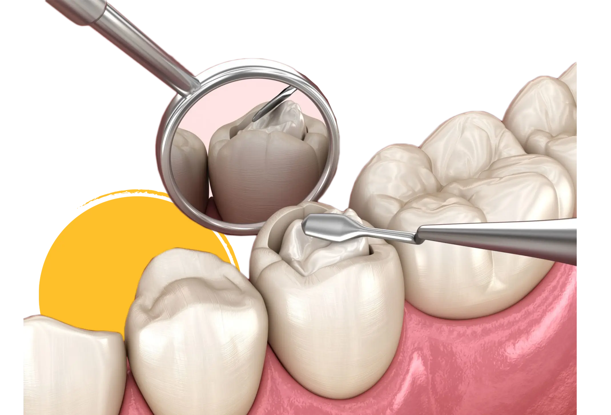 مرکز ترمیم دندان سهروردی